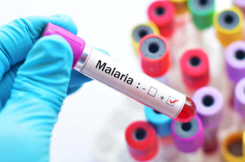Article : Je suis atteint du Paludisme